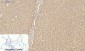 TTR mouse Monoclonal Antibody(1D7)
